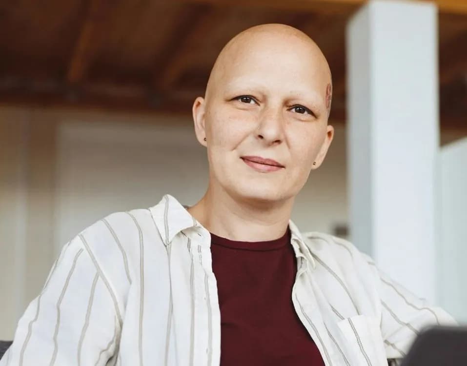 Medicamento para artritis logra notable regeneración capilar en pacientes con alopecia